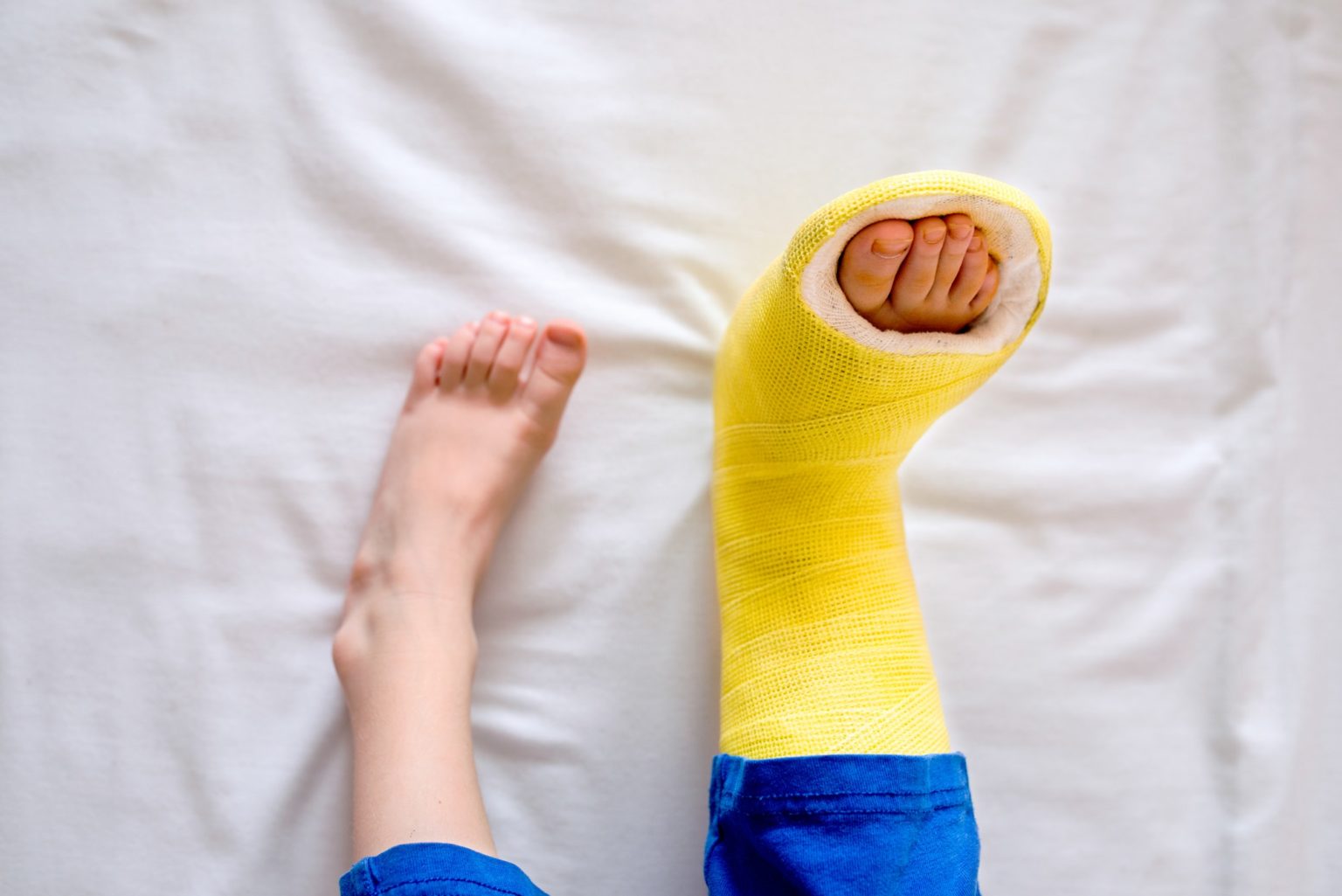 Avulsion Fracture Sports Medicine Information